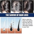 thumbnail image 3 of 1-3x Nueva crema para el tratamiento de la alopecia, previene el crecimiento del cabello, la calvicie y la recaída, 20 g, 1 unidad, 3 of 5