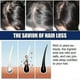 thumbnail image 3 of 1-3x Nueva crema para el tratamiento de la alopecia, previene el crecimiento del cabello, previene la calvicie y la regeneración, 20 g, 1 unidad, 3 of 5