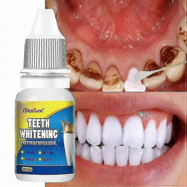 Teeth Whitening Serums Cleaning Oral Hygiene Dental Care Products Removing Pigment Plaque Stains Fresh Breath Teeth Bleaching Tools