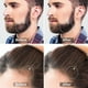 thumbnail image 4 of Rodillo dermaroller para el crecimiento del cabello y la barba - Rodillo de microagujas para barba Dermaroller para rostro, cuerpo, cuero cabelludo, hombres y mujeres, 0,5 mm, 4 of 5