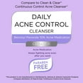 Equate Daily Acne Control Cleanser Cream, 5 oz