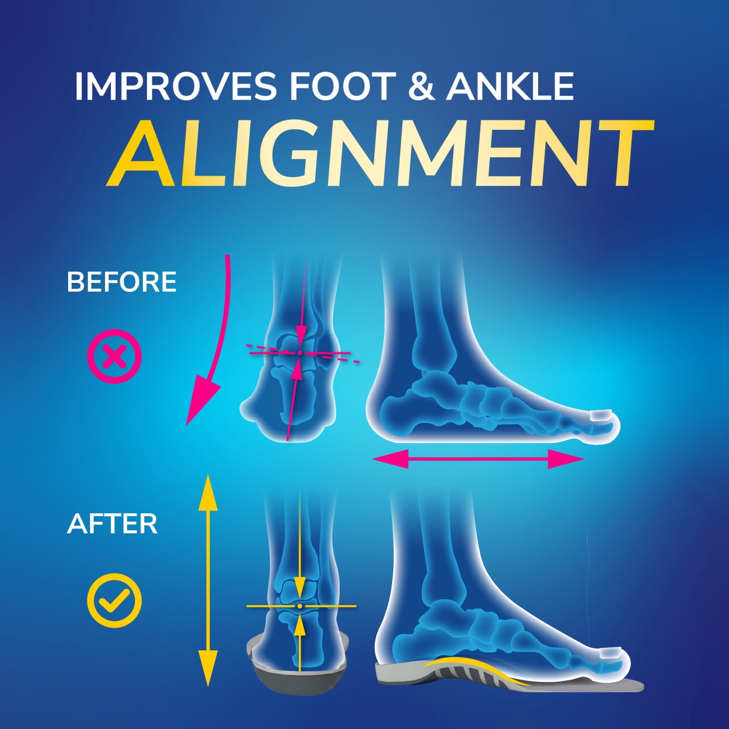 Dr. Scholl's Flat Feet Insoles, Women, - 1 Pair