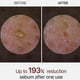 thumbnail image 4 of Dr.Melaxin PEEL SHOT GLOW EXFOLIANT RICE AMPOULE (WHITE RICE/BLACK RICE) 80ml, 4 of 5