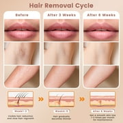 Laser Hair Removal, SweetLF IPL Hair Removal Device for Women and Men, 999999 Flashes for Arm Leg