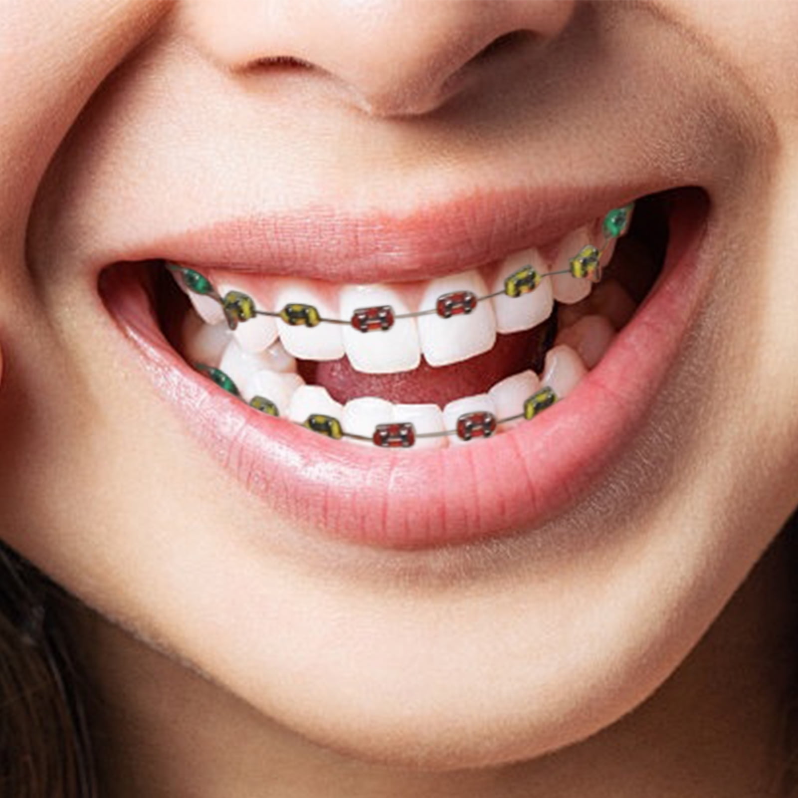 Fake Braces,Kids Fake Braces Lip Protector Colorful Braces Wire,Teeth Braces Wire Stylish Teeth Cosplay Braces for Dentists Kids