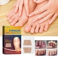 thumbnail image 5 of Tratamiento para hongos en las uñas de los pies, 32 unidades. Tratamiento reparador de uñas, restaura la apariencia de uñas descoloridas o dañadas., 5 of 5