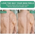 thumbnail image 4 of Guantes exfoliantes, 2 piezas, exfoliante de spa para baño, ducha, guante exfoliante, exfoliante corporal, guante removedor de piel muerta para mujeres y hombres, cepillo, esponja de lufa, 4 of 6
