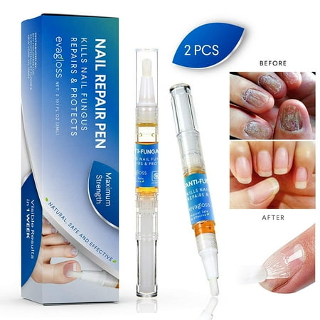 Evagloss Fungus Stop Anti fungal Nail Solution - Kills Fungus on Toenails & Fingernails Solution Repairs & Protects from Discoloration Brittle and Cracked Nails 2 pcs