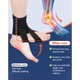 thumbnail image 2 of SIMDOO Adjustable Foot Drop Brace, Ankle Foot Orthosis Support for Walking, Wear with Shoes, Socks or Bare Feet, Day & Night Use, Comes with Massage Ball,Includes A Massage Ball, 2 of 6