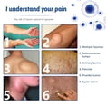 thumbnail image 3 of Crema para el tratamiento de lipomas previene la inflamación mejora la circulación crema para eliminar lipomas para bultos corporales ANGGREK Otros, 3 of 8