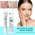 thumbnail image 3 of Crema para el acné LIWEI con ácido salicílico Aceite de árbol de té cuidado suave, 3 of 14