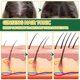 thumbnail image 3 of NEW Herbal Spray Regrowth Nourishing Ginger Oil Serum Promote Quickly Grow Thick Hair Growth Products, 3 of 4