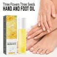 Three Flowers And Three Hand And Foot Oil Itchy Feet Hands Moisturizes