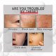thumbnail image 3 of Fade Wrinkles Ampoule Serum Erases Lines Wrinkles Firms Lifts Make Skin More Hydrated Face 30ml, 3 of 5