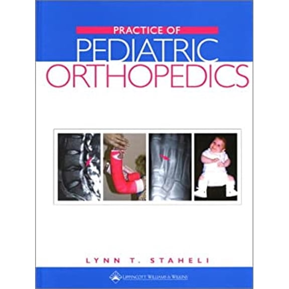 Pre-Owned Practice of Pediatric Orthopedics (Hardcover)