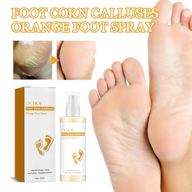 Spray de Naranja para Callos y Callos En Los Pies (30 Ml) | Ayuda con Callos Ásperos y Problemas de Piel | Ingredientes Naturales | Hidrata y Promueve La Salud de La Piel