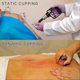 thumbnail image 5 of Cupping Therapy Set w/ 12 Massage Cups for Back Pain Relief Physical Therapy with Hand Pump, 5 of 5