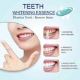 thumbnail image 2 of Beauty Tooth Pen Teeth Oral Care To Remove Yellow Teeth Teeth To Yellow And Black Clean Teeth Pen Beauty Tooth Pen Gel, 2 of 5