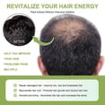 thumbnail image 5 of Rosemary Dense Hair Spray Moisturizes Hair Roots, Increases Elasticity, Restores Luster, Prevents Hair Loss From Solid Hair Spray, 5 of 5