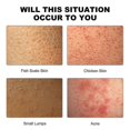 thumbnail image 3 of Deep Cleansing Smooth Cream Cleansing Skin Acne Cutin Dredging Pores Hydrating Tend, 3 of 4