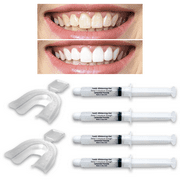 4 Always White Teeth Whitening 22% Gel Syringes! + 2 Free Thermoforming Trays! Made in USA!