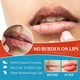 thumbnail image 4 of Bálsamo labial CHAO 20 g tratamiento de queilitis, 4 of 5