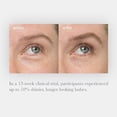 thumbnail image 4 of NULASTIN Eyelash Serum for Thicker Looking Lashes - Follicle Fortifying LASH Serum - Clinically Tested Eyelash Enhancing with Keratin - From the Experts in Brows and Lashes 0.1 Fl Oz, 4 of 7