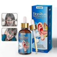 thumbnail image 1 of Tinnitus Drops, Tinnitus Relief For Ears, Tinnitus Oil Relieve Earache,itching Improve Hearing, Ear, 1 of 5