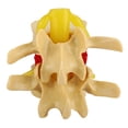 thumbnail image 3 of Modelo De Hernia De Disco Lumbar Humano, Portátil Profesional Práctico 1:1.5 Vértebras Lumbares Humanas Degenerativas, Enseñanza Clínica Para Ortopedia, 3 of 7