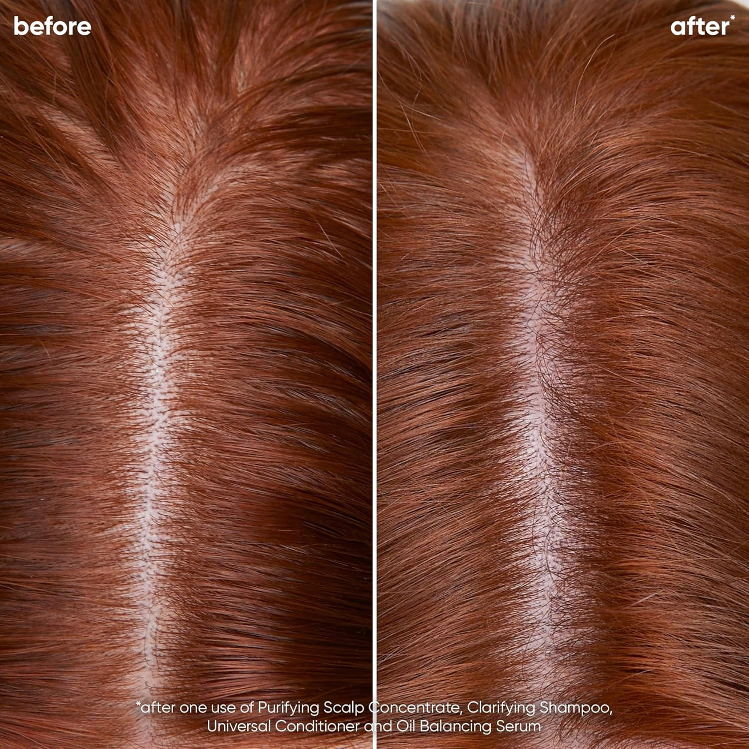 Biolage Scalp Sync Clarifying Shampoo | Removes Residue, Buildup & Excess Oil | Paraben & Silicone Free | For Oily Hair & Scalp | Vegan | Clarifying Salon Shampoo