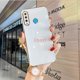 thumbnail image 1 of Funda Huawei P30 Lite/P30 Pro/P20 Elegante Simple A Prueba De Golpes Funda Para Teléfono ZBB, 1 of 4