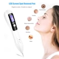 thumbnail image 3 of Fugacal Máquina portátil LCD Dot Mole Freckle Spot Tattoo Removal Pen Beauty Skin Machine White Fugacal No se aplica, 3 of 6