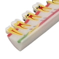 thumbnail image 3 of Modelo de caries dental, 6 etapas diferentes, modelo de exhibición de dientes cariados de resina, 3 of 8