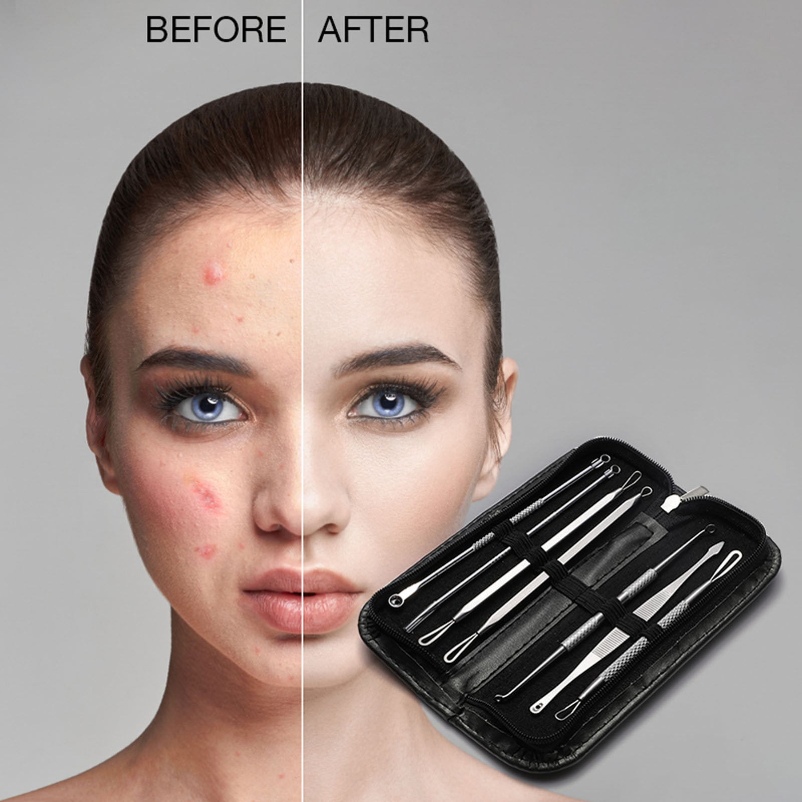 Blackhead Remover Pimple Tool Comedone Zit Extractor Kit For Nose Facial Pore Extraction Popping Needle