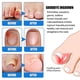thumbnail image 4 of Anti-Infection Toenail Repair Cream, Quick Absorption Nail Strengthening Cream, For Damaged-Nails, 4 of 5