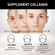 Retinol Cream for Face, Harvey Ross Retinol Face Cream Retinol Moisturizer, Miracles Retinol Cream, Retinol Face Cream for Anti Aging & Wrinkled Skin, Retinol Collagen Facial Care