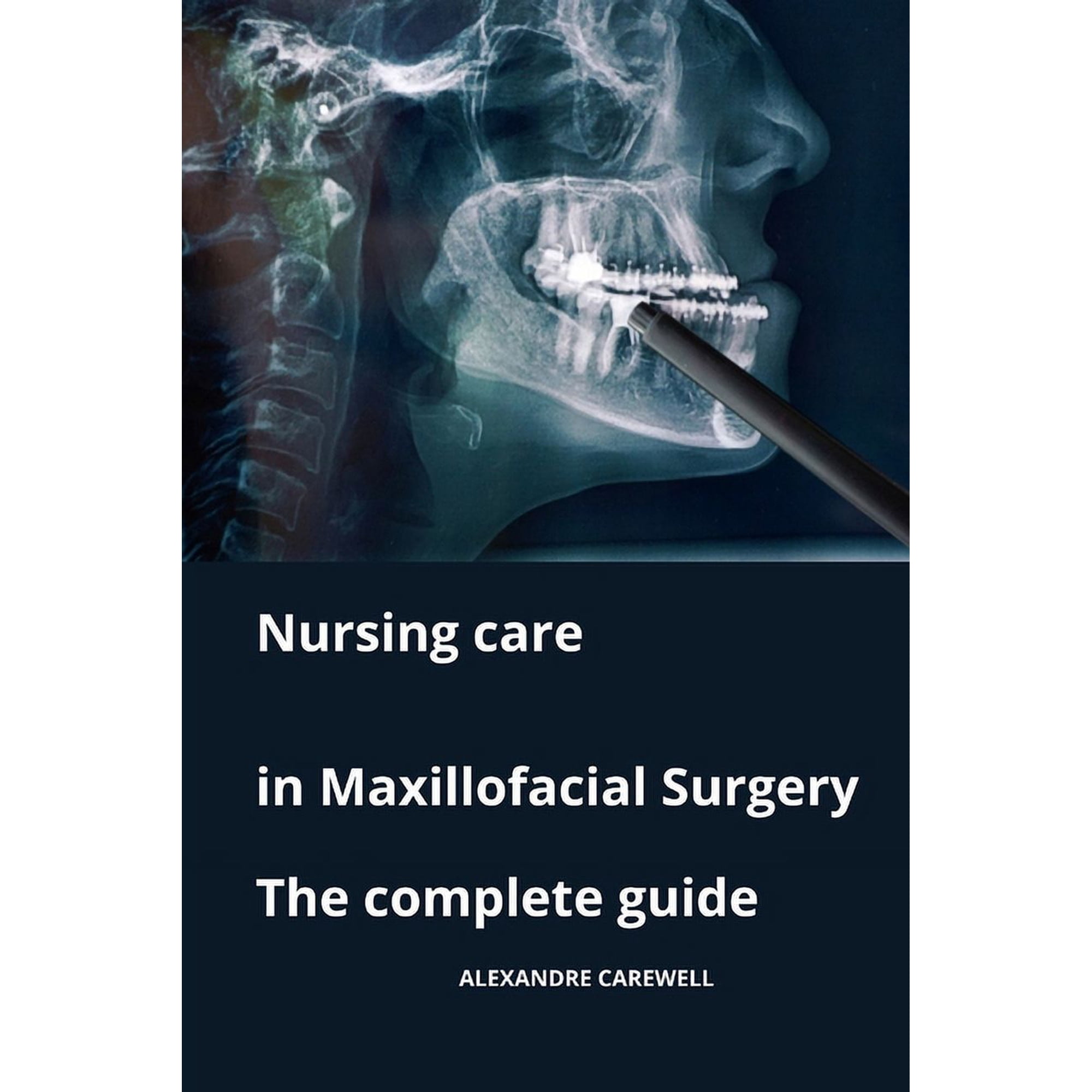 Nursing Care with Alexandre Carewell Nursing Care in Maxillofacial Surgery The complete Guide, Book 27, (Paperback)