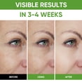 thumbnail image 4 of Eye Cream for Puffy Eyes and Dark Circles, Eye Tightener Cream For Under Eye Bags, Eye Serum Eye Bags Treatment For Women, 4 of 9