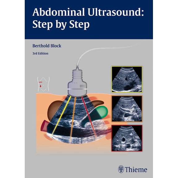 Abdominal Ultrasound: Step by Step, (Paperback)