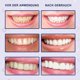 thumbnail image 3 of z Teeth Whitening, 28 Bleaching Teeth Whitening Stripes, White Teeth Bleaching Non Sensitive, Teeth Whitening Stripes, All Teeth Stains Quickly Re, 3 of 4