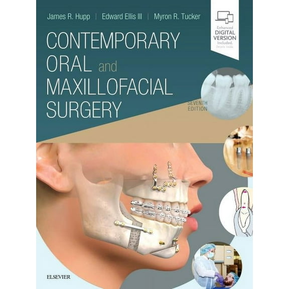 Contemporary Oral and Maxillofacial Surgery, (Hardcover)