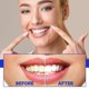 thumbnail image 2 of Pasta de dientes blanqueadora Jaysuing Bicarbonato de sodio Maracuyá Arándano Eliminación de manchas Combate el sangrado de encías Aliento fresco Limpiador bucal Aike |, Arándano en caja, 2 of 3