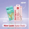 thumbnail image 3 of ONYX Professional 3 Piece Bye Ingrown Toenail Removal Kit, 3 of 7