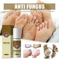 thumbnail image 4 of Shoe Deodorizer - Foot Spray and Shoe Odor Eliminator - No More Smelly Shoes or Stinky Feet with our Peppermint Shoe Freshener,3PCS, 4 of 8