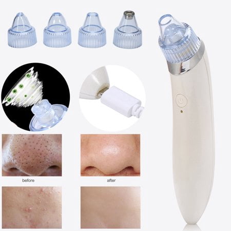 Sonew Electric Acne Pimple Skin Pore Cleaner Nose Blackhead Suction Remover Beauty