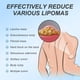 thumbnail image 3 of Ungüento para Lipoma, Pasta para Remover Lipoma, Pasta Herbal Natural para Remover Grumos de Lipoma, Ungüento en Pasta para Remover Lipoma (Buy 2 get 1 free), 3 of 8