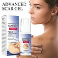 Scar Gel Fade Body Facial Scar Pregnancy Scar Smoothing Skin Care Gel