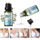 thumbnail image 1 of Aceite Esencial A Base De Hierbas Bust Up, Crema Para Realzar Los Senos, Aceite Esencial Natural Bust Up, Aceite Esencial Para Dar Volumen A Los Senos, 1 of 5