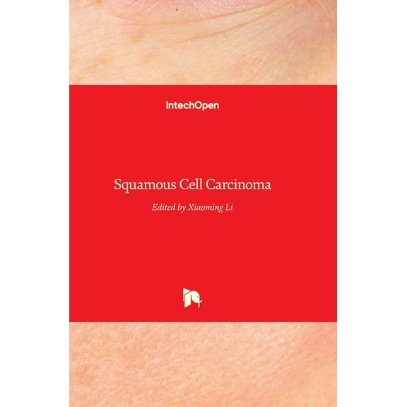 Squamous Cell Carcinoma (Hardcover)