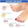 thumbnail image 2 of Toe Spreaders & Separators, Fast Pain Relief from Hammertoe & Bunions, Latex-Free Rubber Toe Stretchers Used for Nighttime, Yoga, Exercise, 1 Pairs, 2 of 5